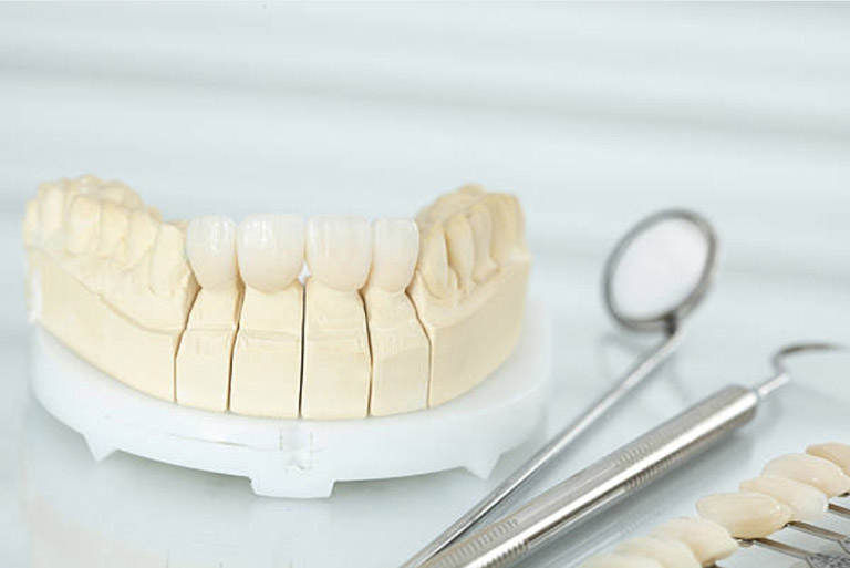Dentalna protetika